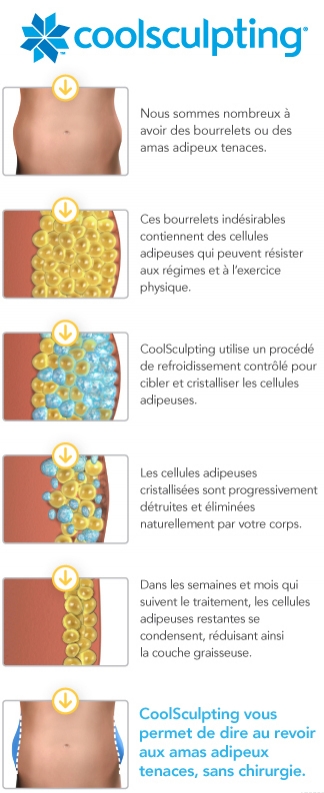 Le principe de fonctionnement du Coolsculpting